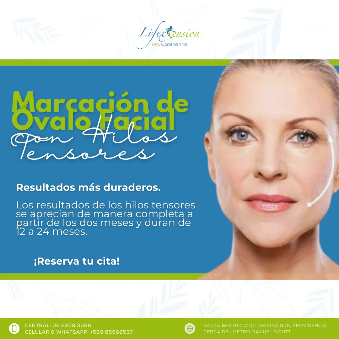 Marcación de óvalo facial (hilos tensores)