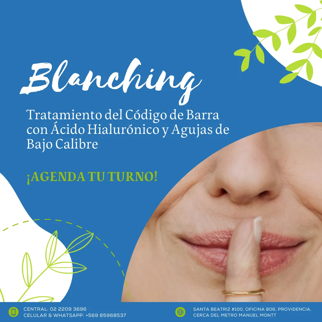 Tratamiento de blanching