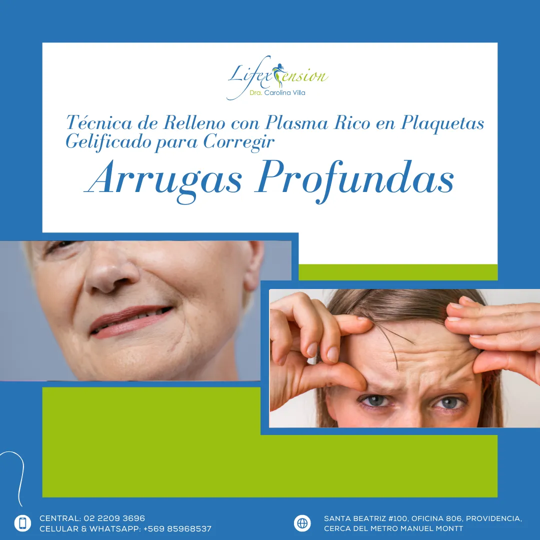29 Tratamiento Plasma Gel Plus