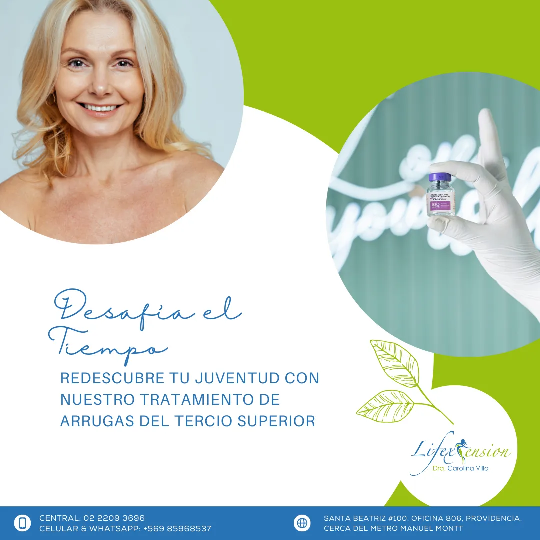 Arrugas del tercio superior (botox)
