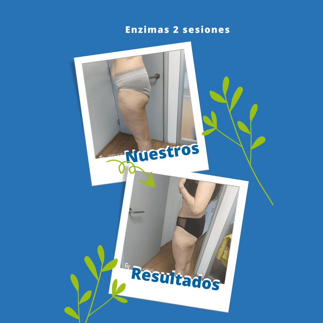 Resultados de enzimas