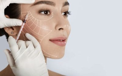 ¿Qué es el lifting sin cirugía y cuáles son sus beneficios?